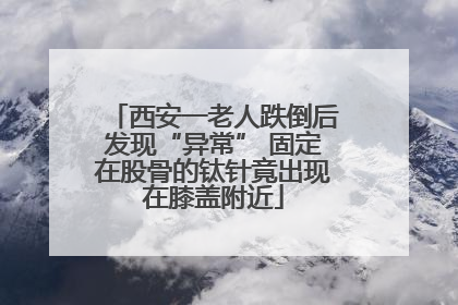 西安一老人跌倒后发现“异常” 固定在股骨的钛针竟出现在膝盖附近
